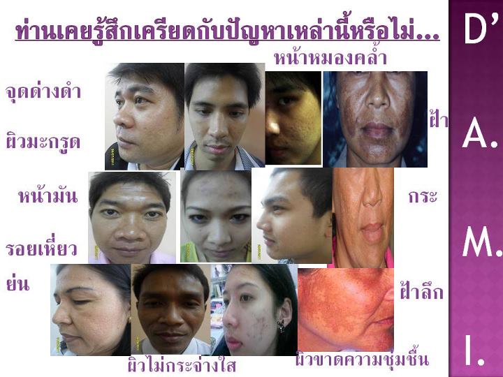 เครื่องสำอาง d'Ami Set ดูแลผิวหน้าให้อ่อนเยาว์อยู่เสมอ