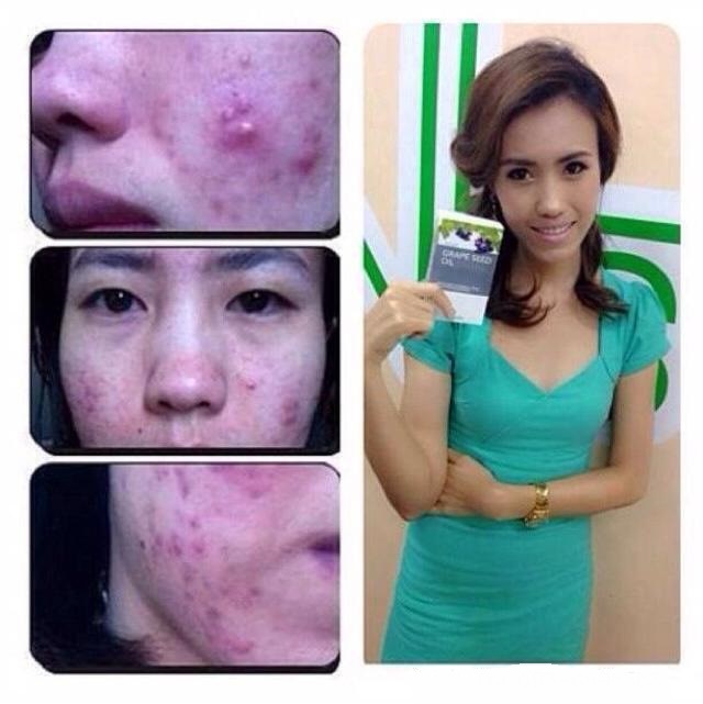 Grape Seed Oil น้ำมันเมล็ดองุ่น (สกัดเย็น)