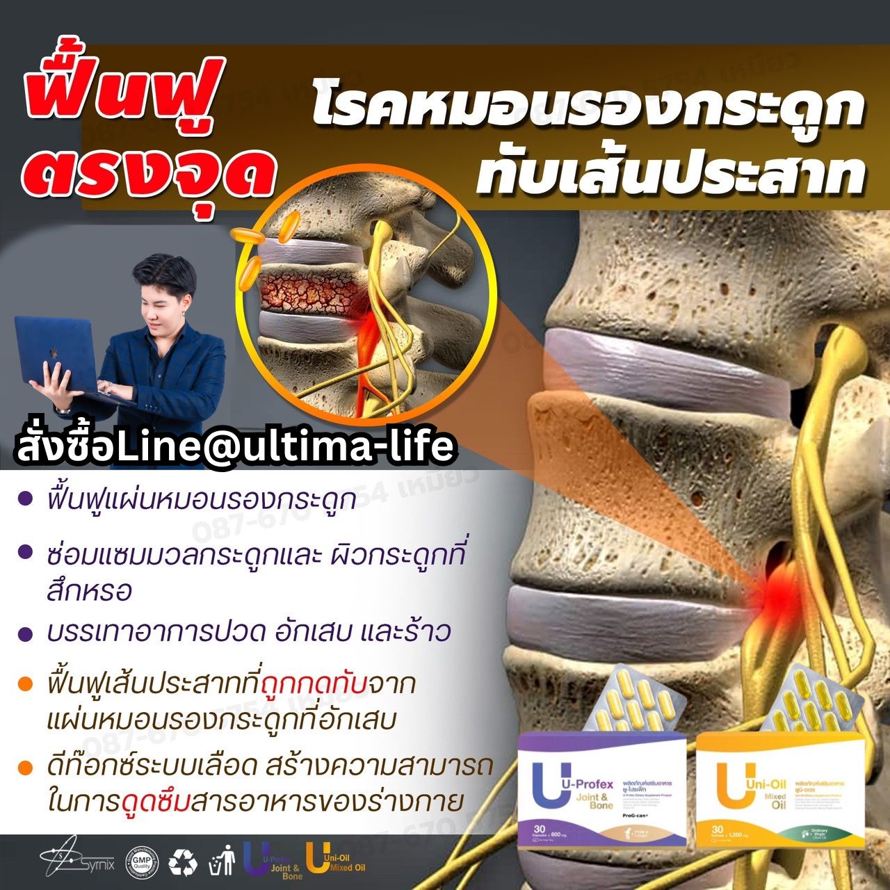 U Profex ดูแล หมอนกระดูกทับเส้นประสาท