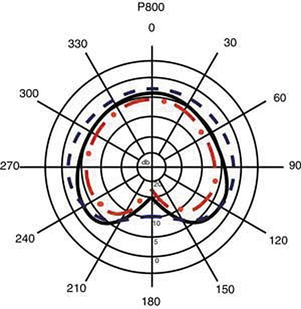 Applied Microphone Technology AMT P800 Trumpet / Flugelhorn Microphone with BP45 Preamp