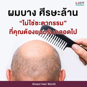 ผมบางแล้วไง ก็แค่ปล่อยผมไว้ตลอด